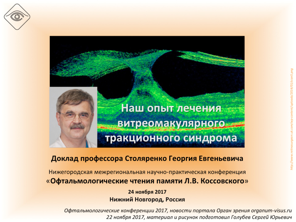 Лечение витреомакулярного тракционного синдрома