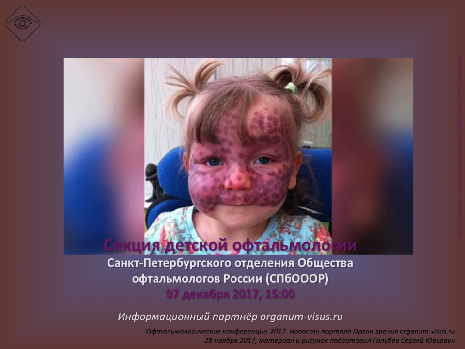 Детская офтальмология СПбОООР