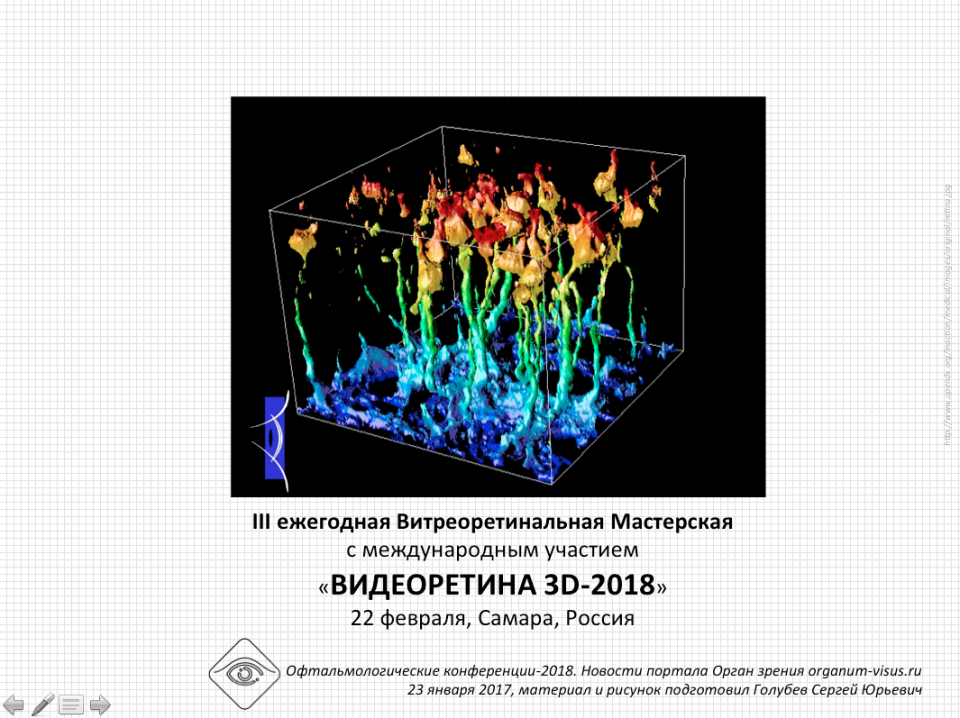 Видеоретина 3D 2018 в Самаре