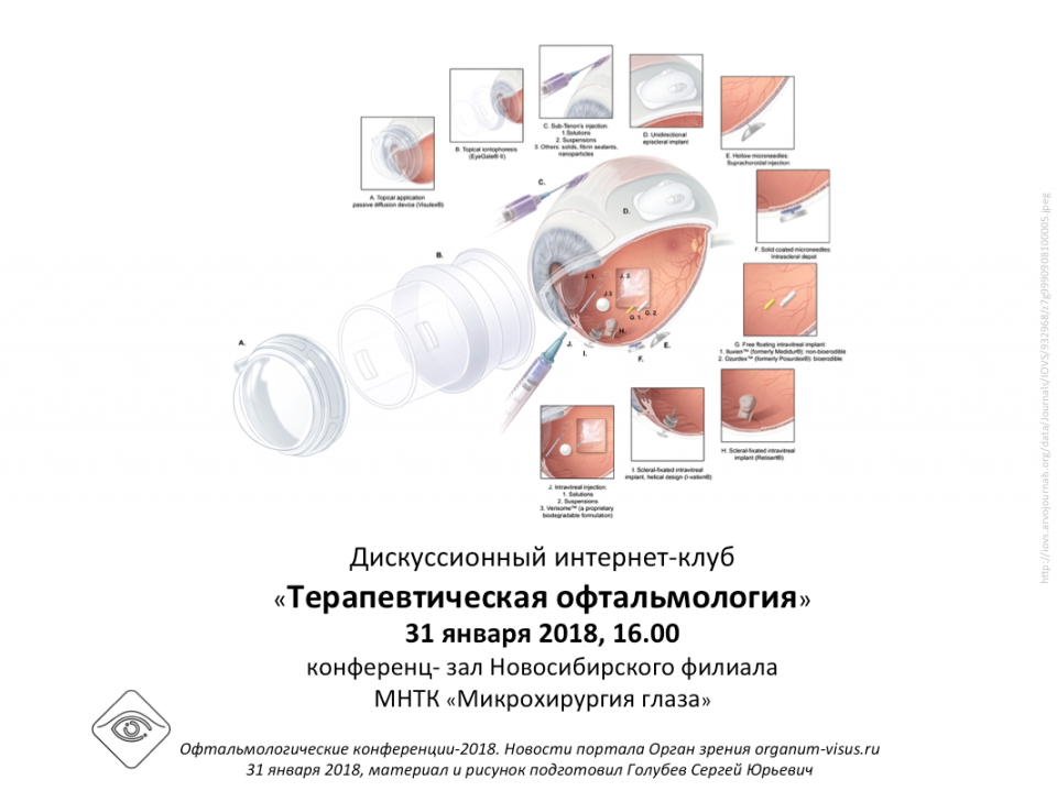 Терапевтическая офтальмология Интернет Клуб в Новосибирске