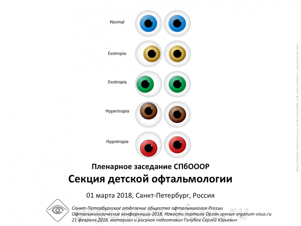 Детская офтальмология Заседание секции СПбОООР