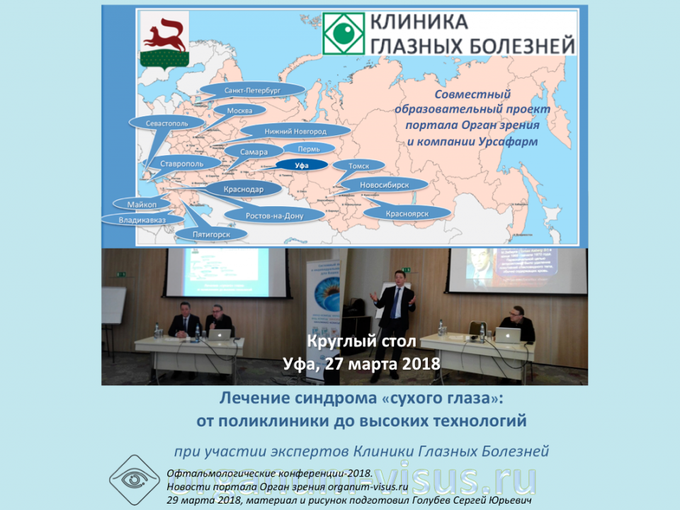 Лечение сухого глаза Круглый стол офтальмологов Уфы