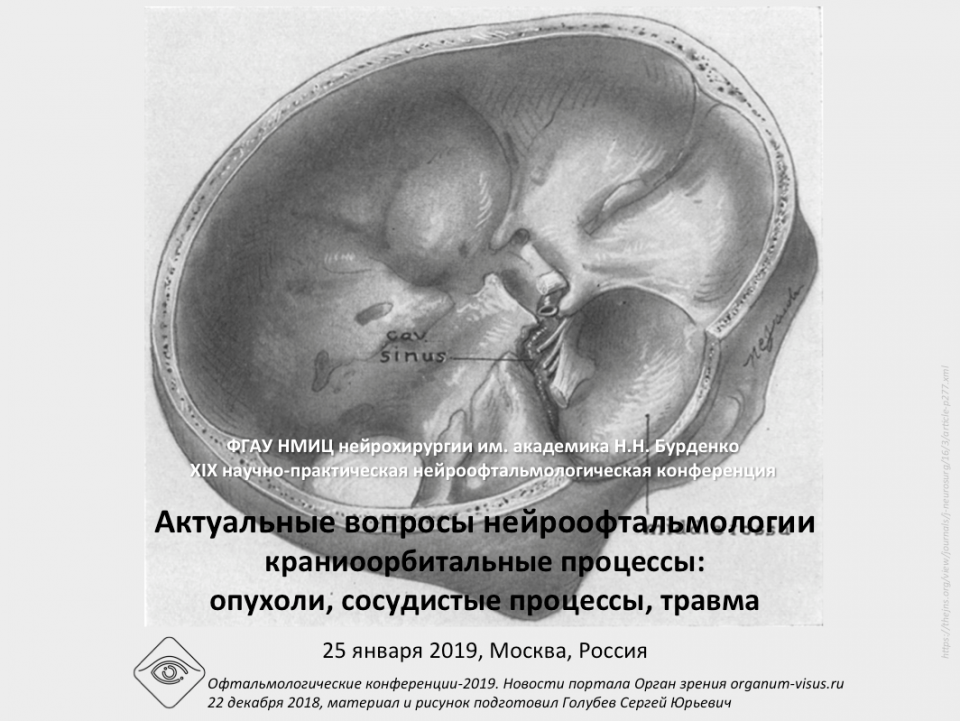Нейроофтальмология Конференция 25 января 2019 Программа