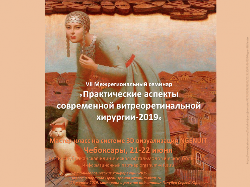 Офтальмохирургия в 3D NGENUITY в Чебоксарах