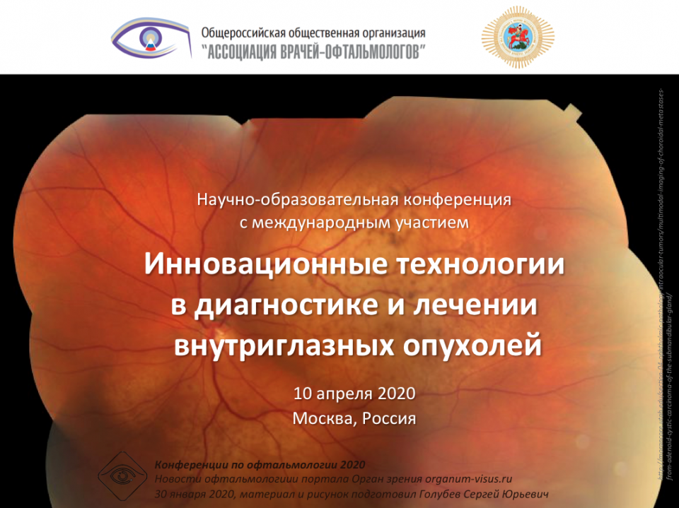 Офтальмоонкология Внутриглазные опухоли 10 апреля 2020
