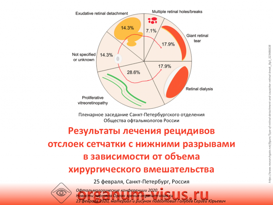 Отслойка сетчатки Заседание СПбОООР 25 февраля 2020