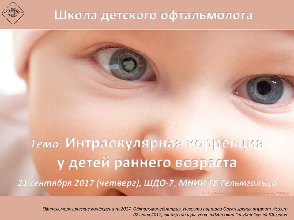 Школа детского офтальмолога