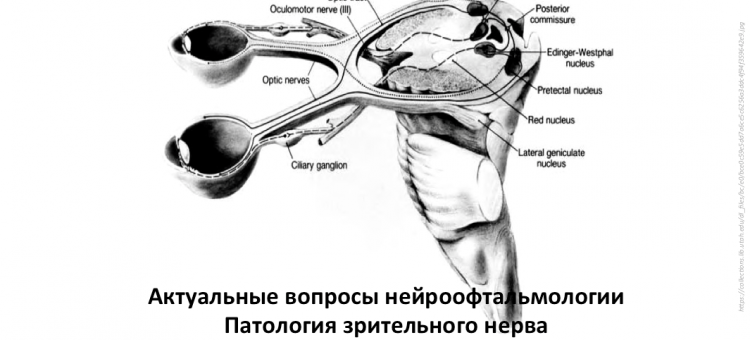 Нейроофтальмология Конференция в Москве
