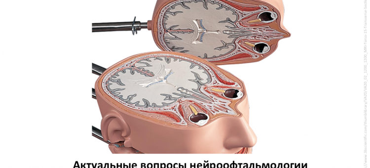 Нейроофтальмология Конференция в Москве Программа