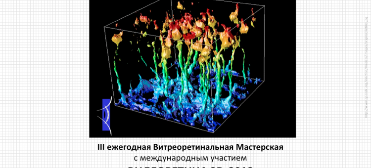 Видеоретина 3D 2018 в Самаре