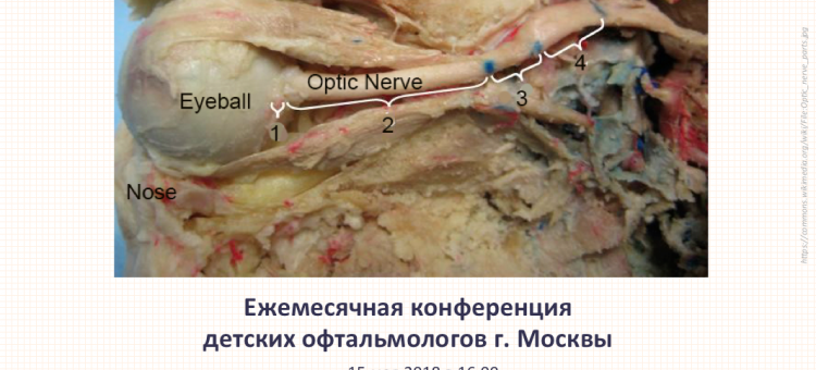 Детская офтальмология Москвы Конференция 15 мая