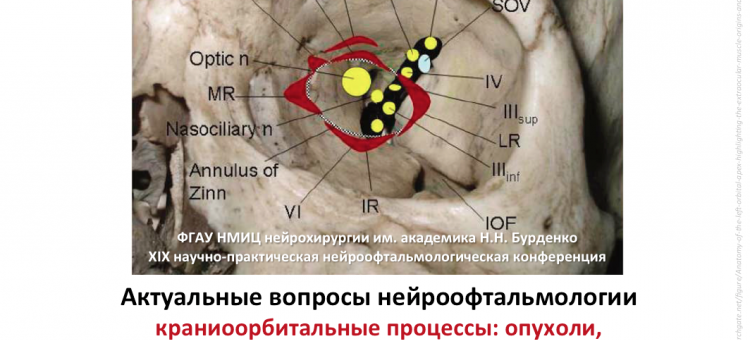 Нейроофтальмология Конференция в столице России