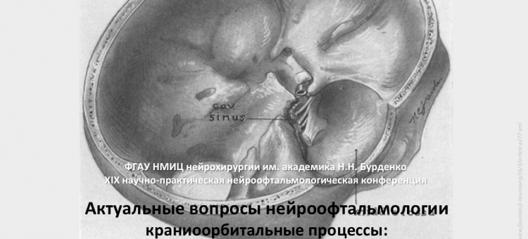 Нейроофтальмология Конференция 25 января 2019 Программа