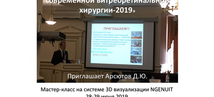 Офтальмология России 3D визуализации NGENUITY Чебоксары