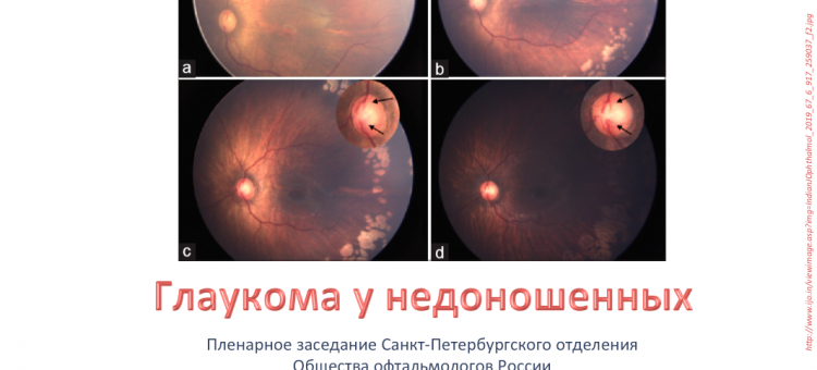 Детская офтальмология Заседание секции СПбОООР