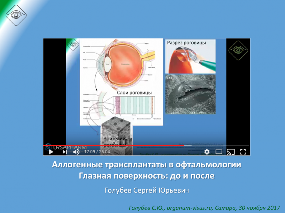 Офтальмопластика Глазная поверхность