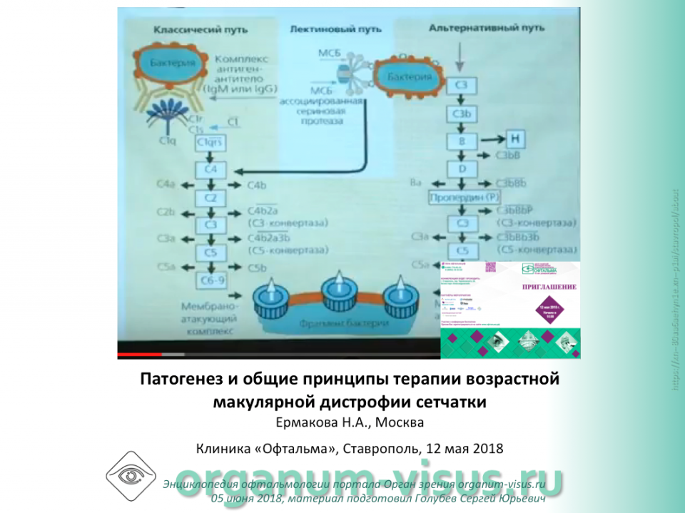 Сетчатка: ВМД патогенез и лечение, Ермакова Н.А.