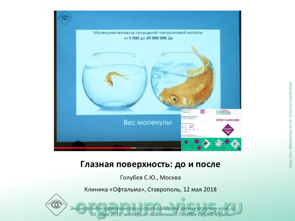 Сухой глаз Глазная поверхность до и после Голубев С.Ю.