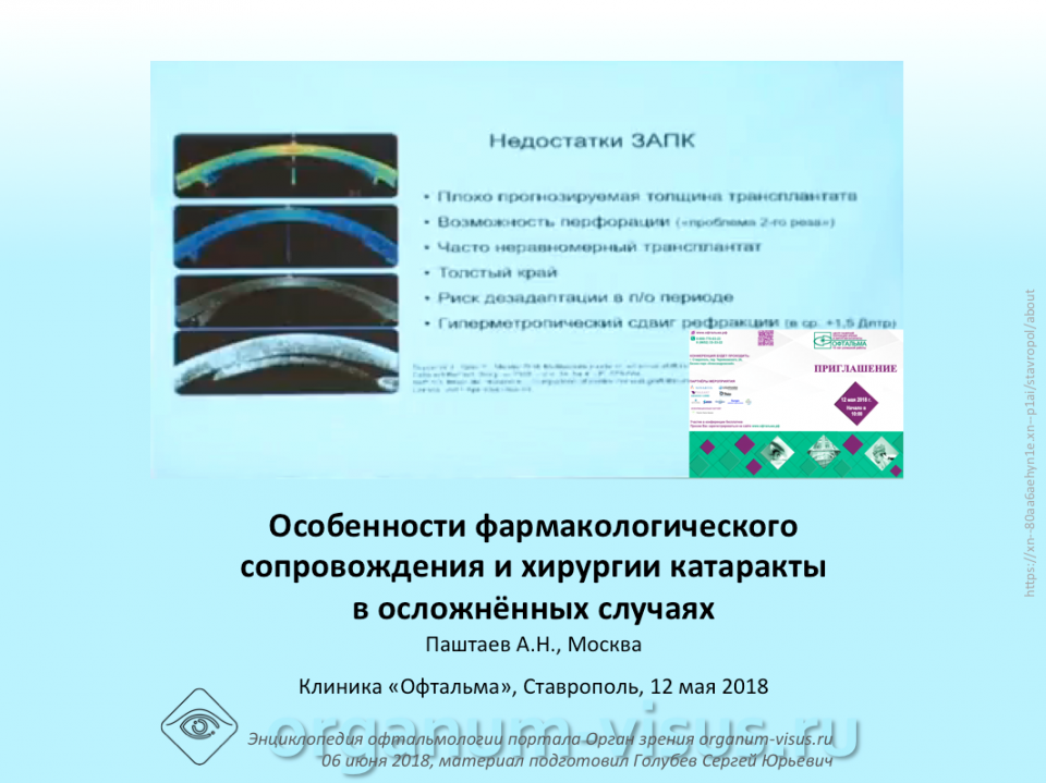 Хирургия катаракты Фрмакологическое сопровождение Паштаев А.Н.