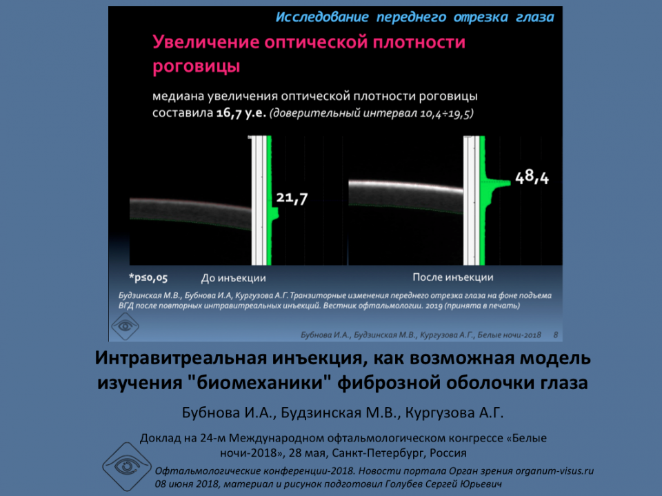 Глаукома ИВИ и биомеханика глаза Бубнова И.А.