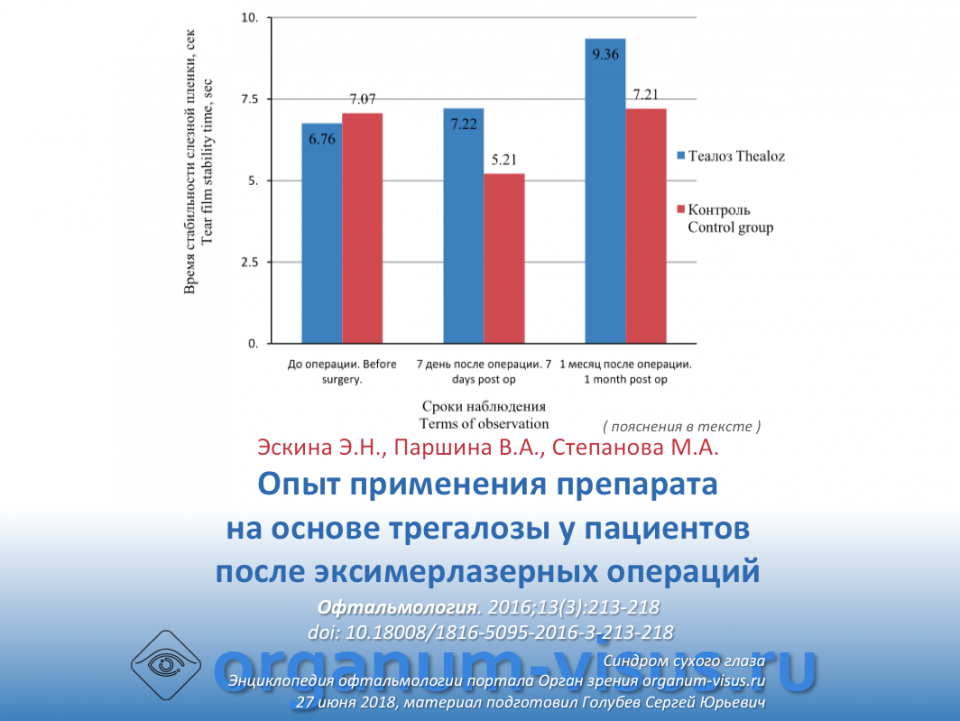 Сухой глаз Трегалоза после эксимерлазерных операций