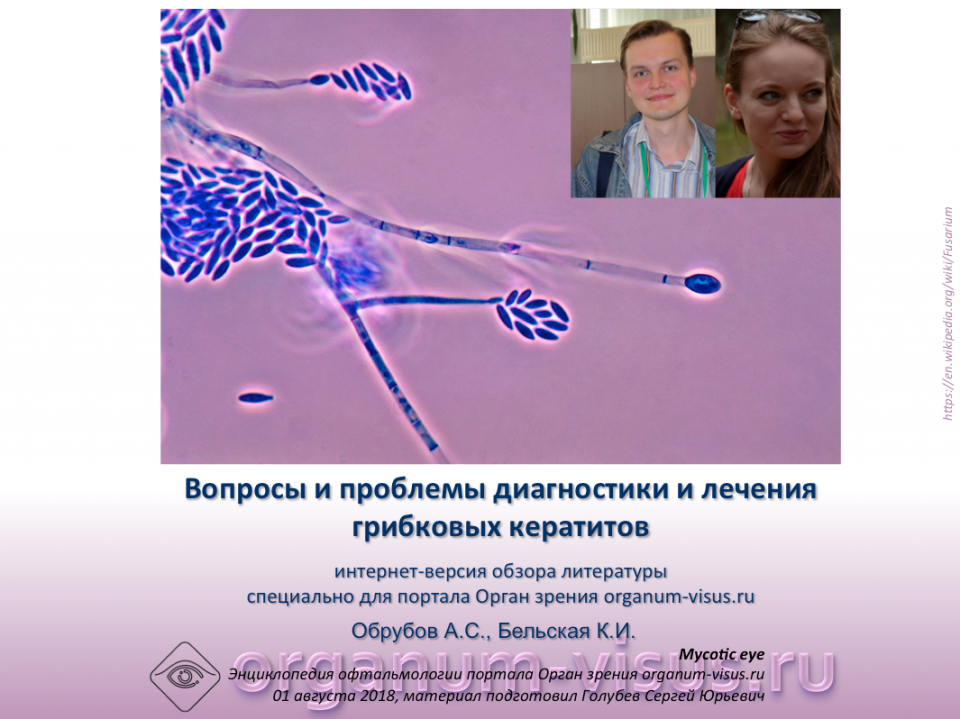 Офтальмомикозы Mycotic eye Грибковые кератиты, Обрубов А.С.