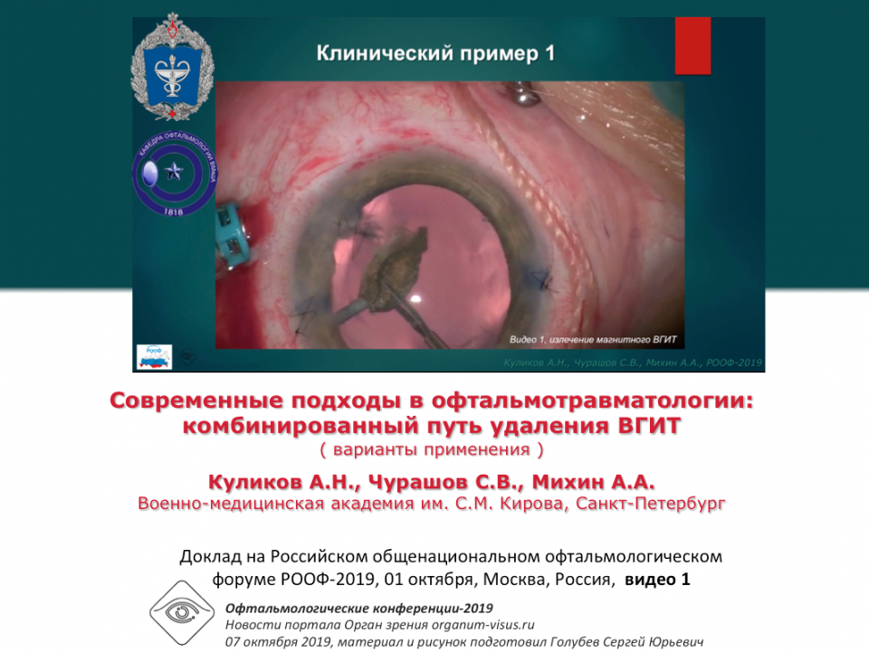 Травма глаза Удаление ВГИТ Видео 1 Куликов А.Н. с соавт