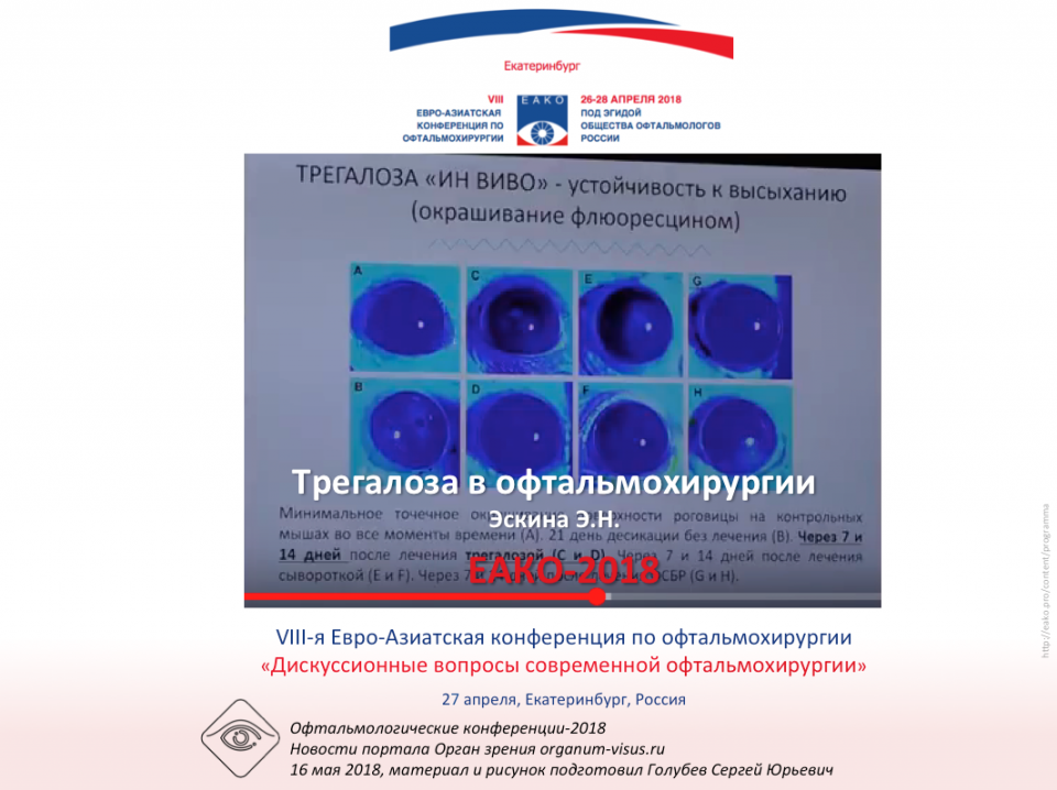 Трегалоза в офтальмохирургии, Эскина Э.Н.