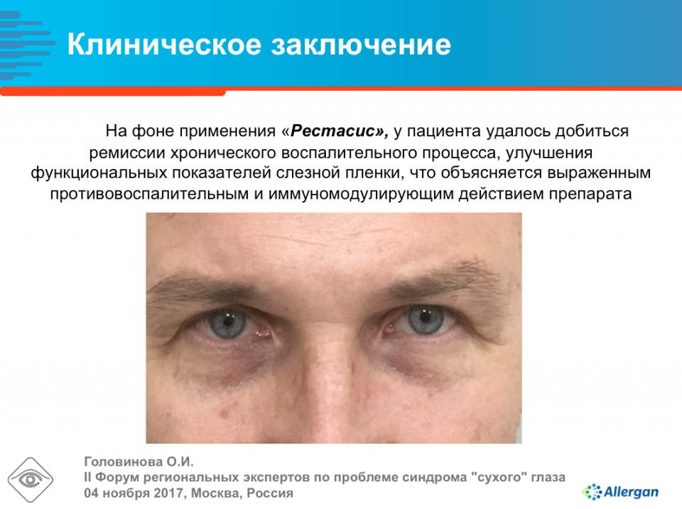 Циклоспорин А 0,05% Вторичный сухой глаз