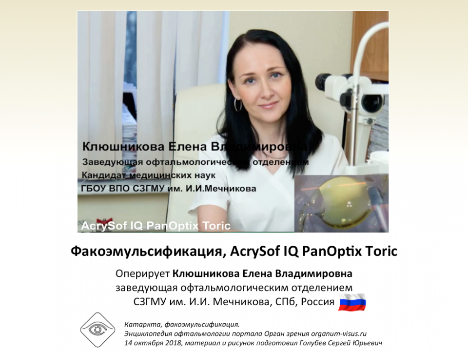 Катаракта AcrySof IQ PanOptix Toric