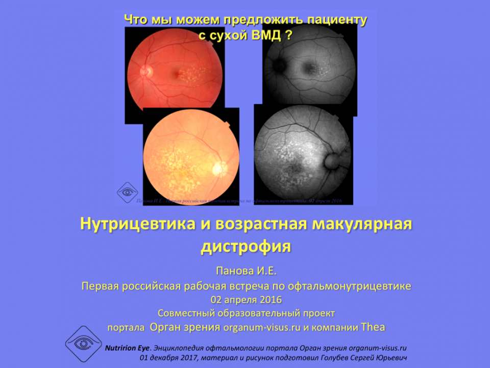 Офтальмонутрицевтика и возрастная макулярная дистрофия, Панова И.Е.