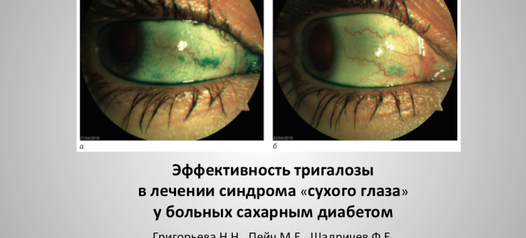 Тригалоза и сахарный диабет Григорьева Н.Н. с соавт.