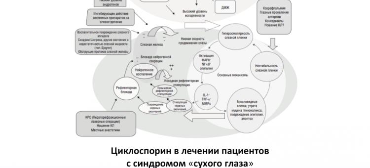 Рестасис Лечение сухого глаза