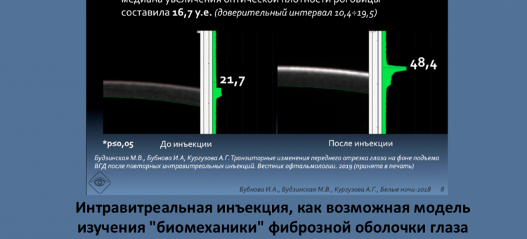 Глаукома ИВИ и биомеханика глаза Бубнова И.А.