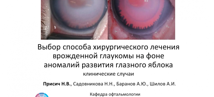 Глаукома и аниридия Тактика лечения