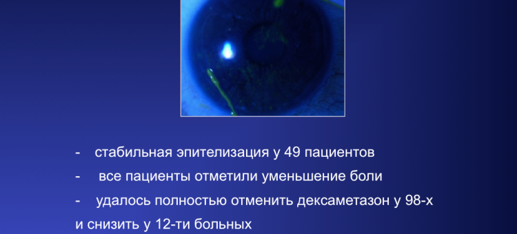 Сухой глаз Средняя степень тяжести Лечение