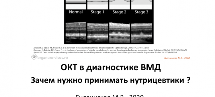 ВМД ОКТ диагностика и нутрицевтики 