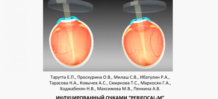 Контроль миопии Перифокал-М Тарутта Е.П. с соавт.