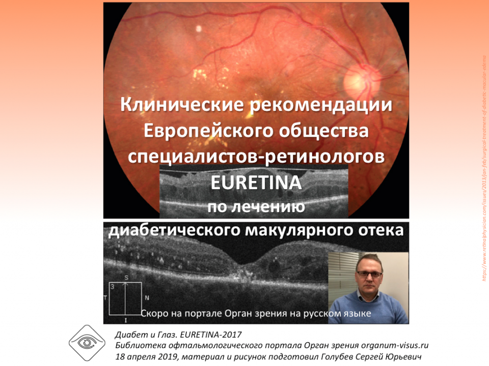 Диабет и Глаз Клинические рекомендации лечения ДМО EURETINA