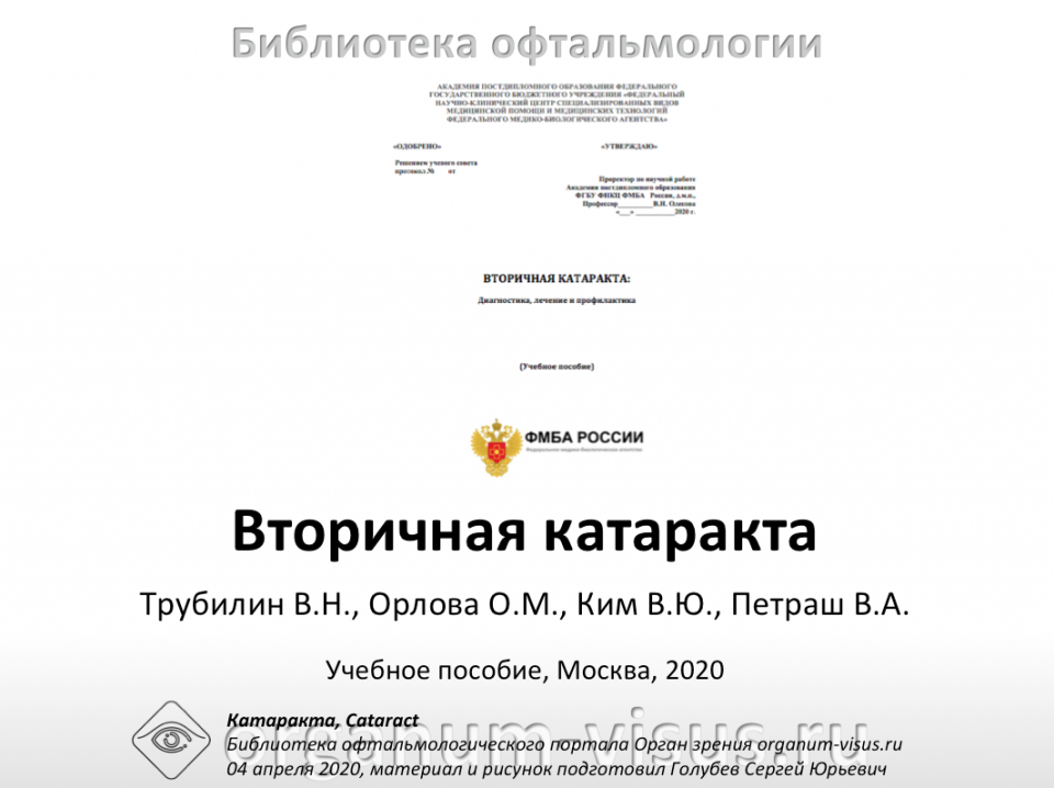 Вторичная катаракта Трубилин В.Н. с соавт., 2020