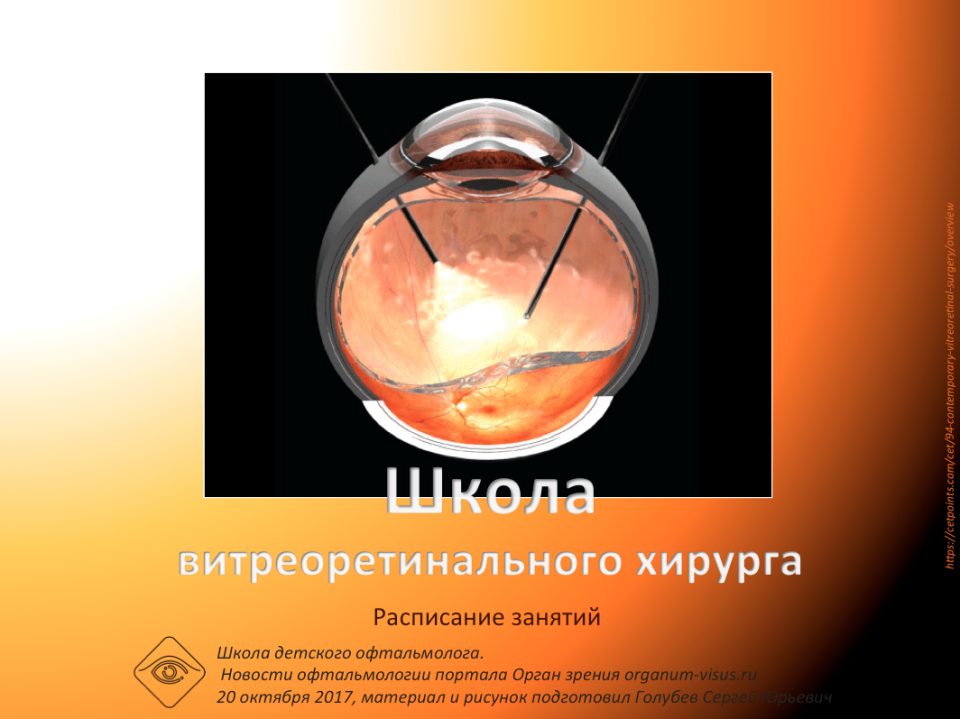 Школа витреоретинального хирурга