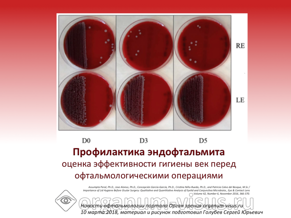 Профилактика эндофтальмита Блефаклин и глазная поверхность