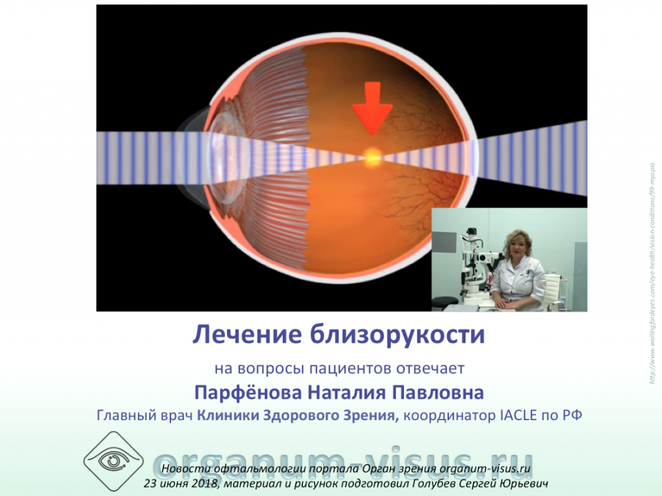 Лечение близорукости у детей Ответы на вопросы пациентов