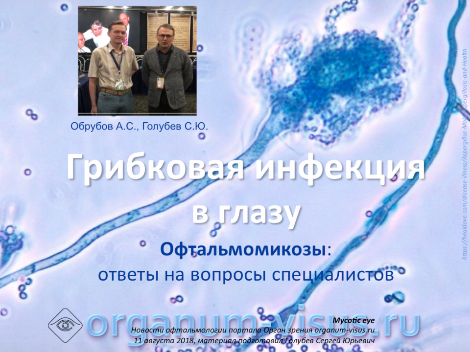 Офтальмомикозы Ответы на вопросы специалистов