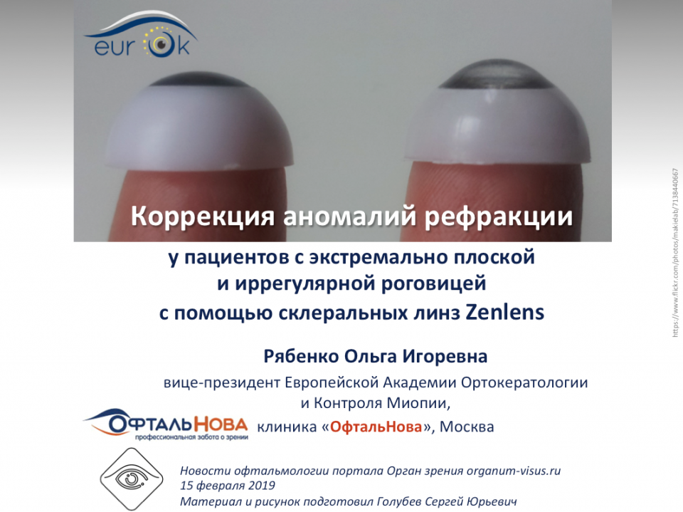 Плоская роговица Склеральные линзы Zenlens