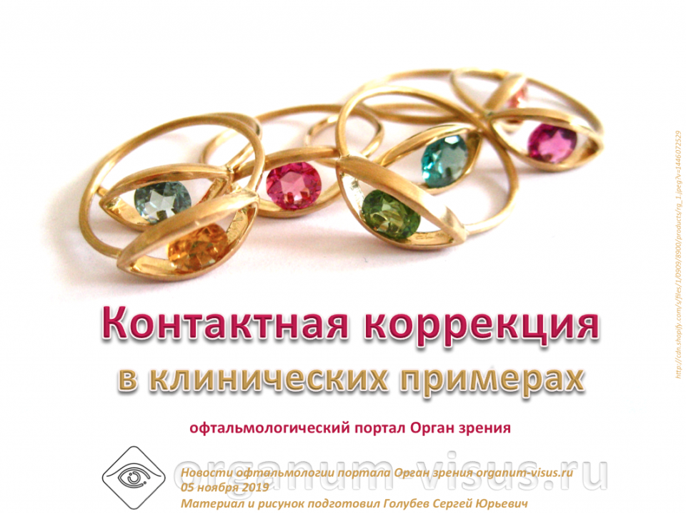 Контактная коррекция в клинических примерах