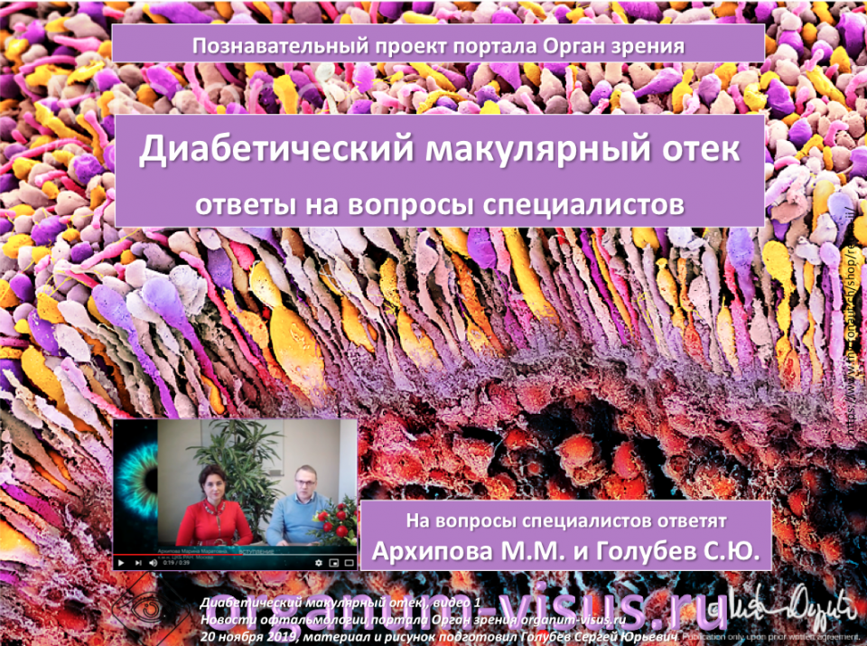 Диабетический макулярный отек Ответы на вопросы