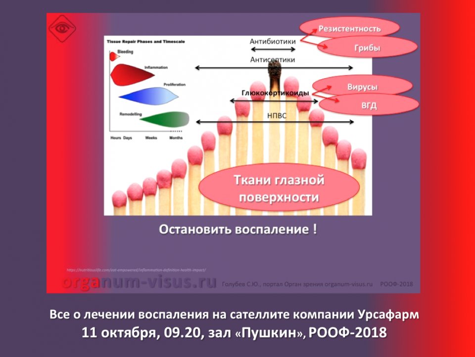 Сухой глаз Лечение воспаления тканей глазной поверхности