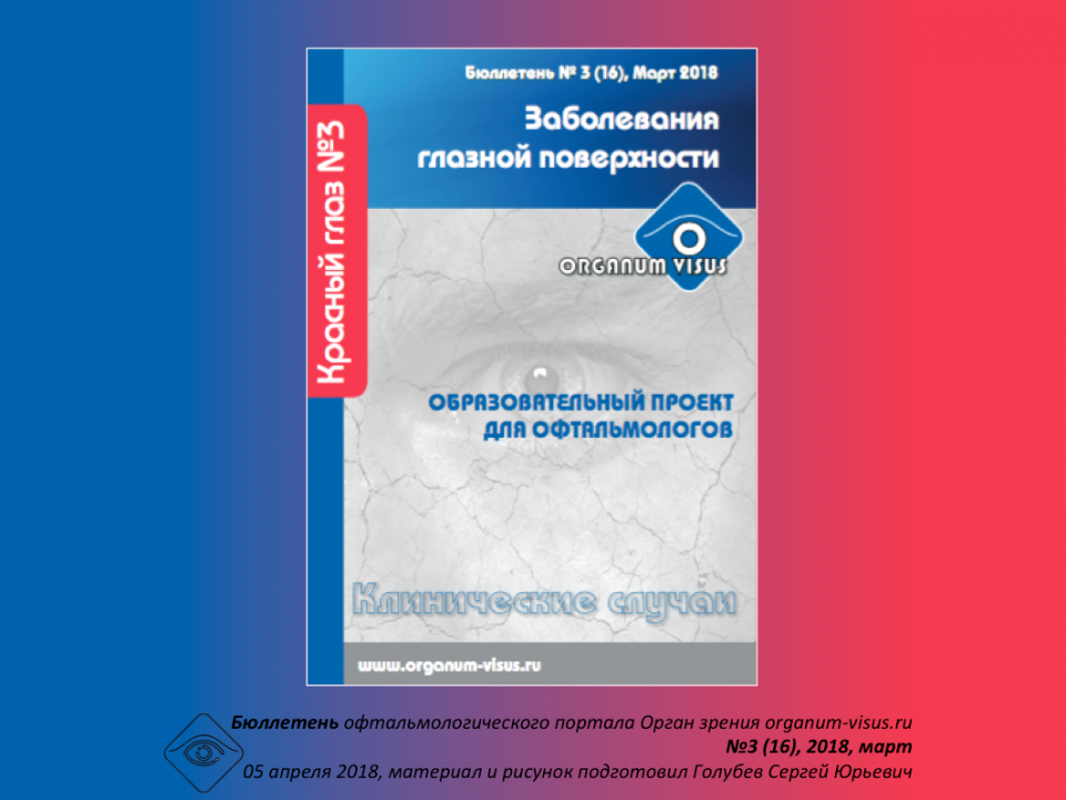 Красный глаз Лечение Бюллетень портала Орган зрения