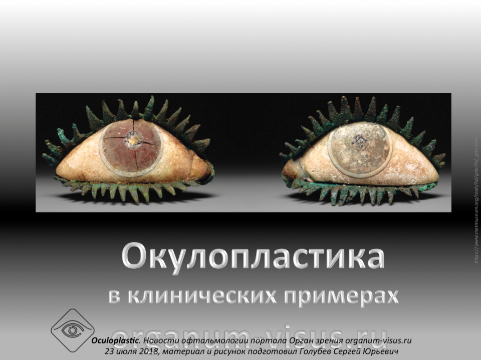 Окулопластика в клинических примерах